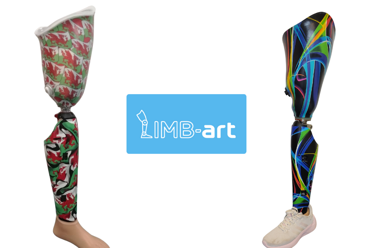 Two images showing prosthetic covers from LIMB Art which have been had the fabric matched.